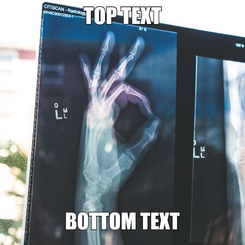 Preview for X-ray-image-meme-template-meme-classic-d4b4b